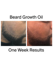 Load image into Gallery viewer, Beard Growth Oil